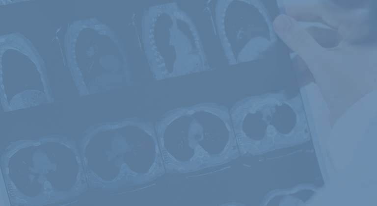 A radiologist examining CT scans A clinitian with CT scans